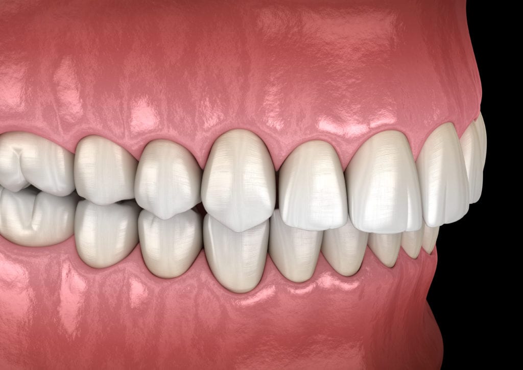Orthodontic Services in Irving TX